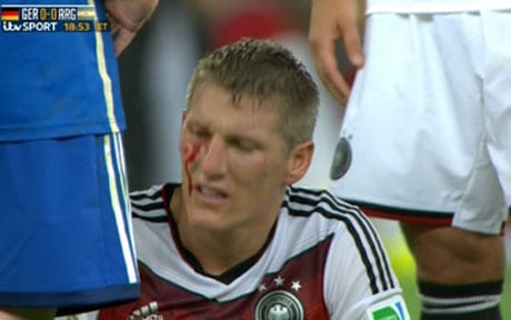 Schweinsteiger hit by Aguero - Football, Astrology and the World Cup